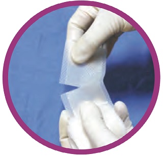 Image of UESCOPE VL460 Single Use Video Laryngoscope